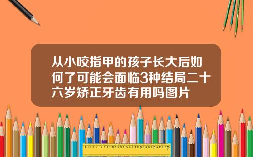 从小咬指甲的孩子长大后如何了可能会面临3种结局二十六岁矫正牙齿有用吗图片