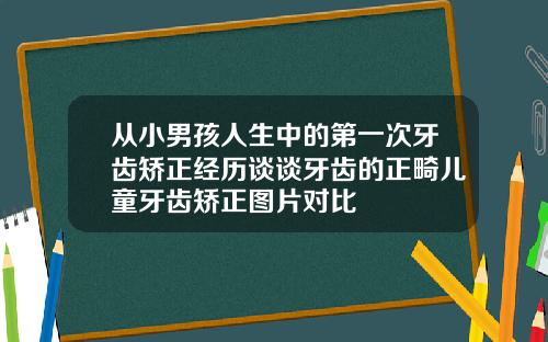 从小男孩人生中的第一次牙齿矫正经历谈谈牙齿的正畸儿童牙齿矫正图片对比