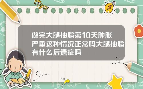 做完大腿抽脂第10天肿胀严重这种情况正常吗大腿抽脂有什么后遗症吗