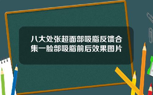 八大处张超面部吸脂反馈合集一脸部吸脂前后效果图片