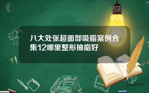 八大处张超面部吸脂案例合集12哪里整形抽脂好