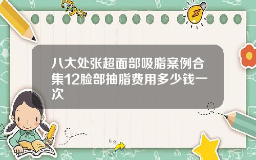 八大处张超面部吸脂案例合集12脸部抽脂费用多少钱一次