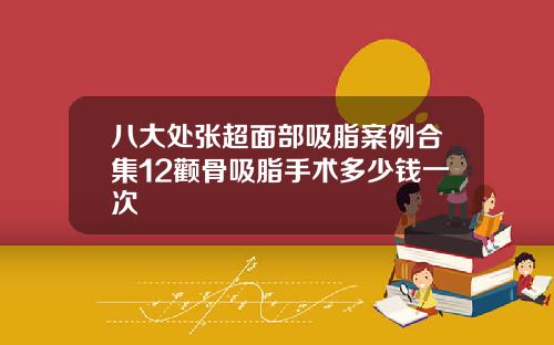 八大处张超面部吸脂案例合集12颧骨吸脂手术多少钱一次