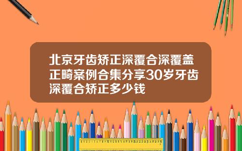 北京牙齿矫正深覆合深覆盖正畸案例合集分享30岁牙齿深覆合矫正多少钱