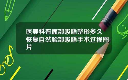 医美科普面部吸脂整形多久恢复自然脸部吸脂手术过程图片