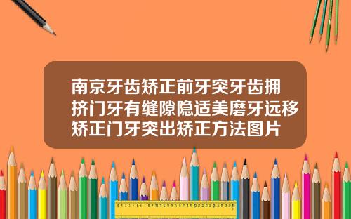 南京牙齿矫正前牙突牙齿拥挤门牙有缝隙隐适美磨牙远移矫正门牙突出矫正方法图片