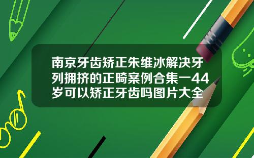 南京牙齿矫正朱维冰解决牙列拥挤的正畸案例合集一44岁可以矫正牙齿吗图片大全