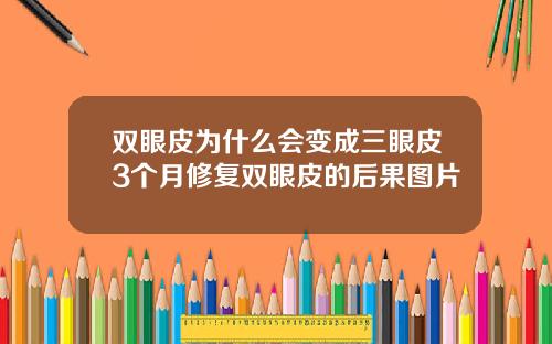 双眼皮为什么会变成三眼皮3个月修复双眼皮的后果图片