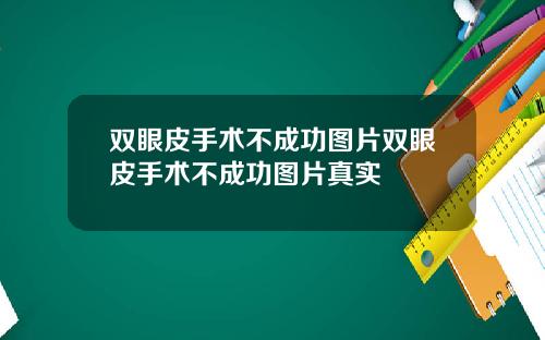 双眼皮手术不成功图片双眼皮手术不成功图片真实