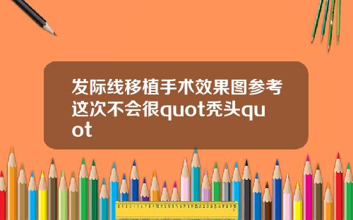 发际线移植手术效果图参考这次不会很quot秃头quot