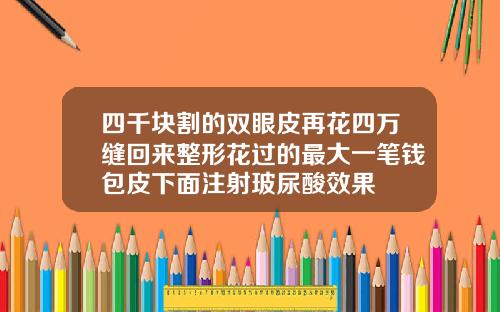 四千块割的双眼皮再花四万缝回来整形花过的最大一笔钱包皮下面注射玻尿酸效果