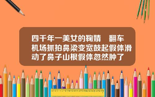 四千年一美女的鞠婧祎翻车机场抓拍鼻梁变宽鼓起假体滑动了鼻子山根假体忽然肿了