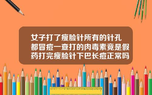 女子打了瘦脸针所有的针孔都冒痘一查打的肉毒素竟是假药打完瘦脸针下巴长痘正常吗