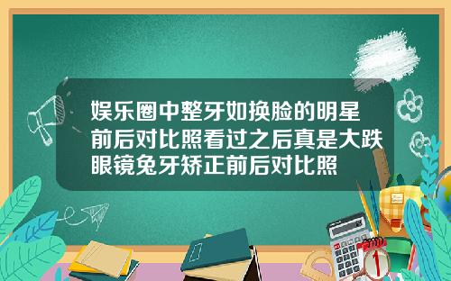 娱乐圈中整牙如换脸的明星前后对比照看过之后真是大跌眼镜兔牙矫正前后对比照