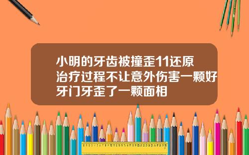 小明的牙齿被撞歪11还原治疗过程不让意外伤害一颗好牙门牙歪了一颗面相