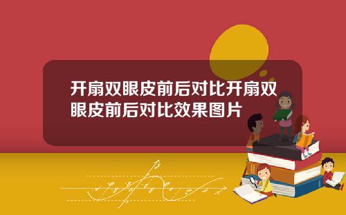 开扇双眼皮前后对比开扇双眼皮前后对比效果图片