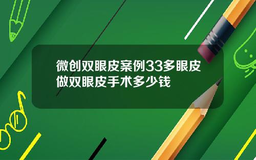 微创双眼皮案例33多眼皮做双眼皮手术多少钱