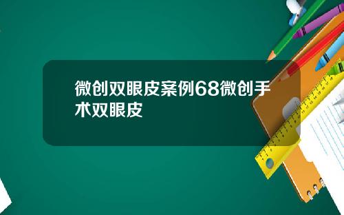 微创双眼皮案例68微创手术双眼皮