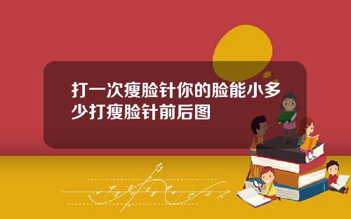 打一次瘦脸针你的脸能小多少打瘦脸针前后图
