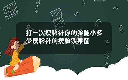 打一次瘦脸针你的脸能小多少瘦脸针的瘦脸效果图