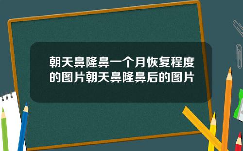 朝天鼻隆鼻一个月恢复程度的图片朝天鼻隆鼻后的图片