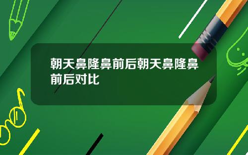 朝天鼻隆鼻前后朝天鼻隆鼻前后对比