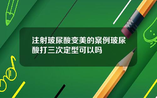 注射玻尿酸变美的案例玻尿酸打三次定型可以吗