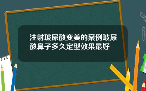 注射玻尿酸变美的案例玻尿酸鼻子多久定型效果最好