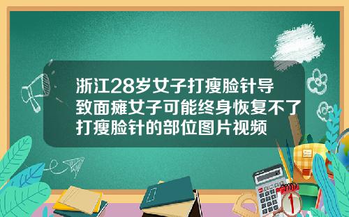 浙江28岁女子打瘦脸针导致面瘫女子可能终身恢复不了打瘦脸针的部位图片视频