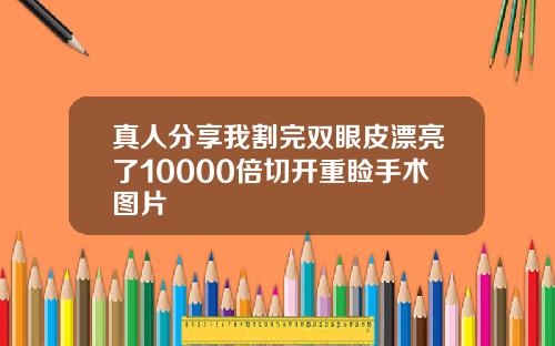 真人分享我割完双眼皮漂亮了10000倍切开重睑手术图片
