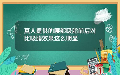 真人提供的腰部吸脂前后对比吸脂效果这么明显