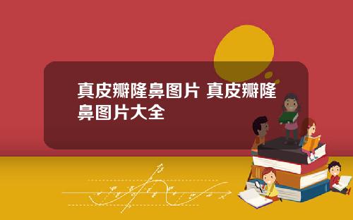 真皮瓣隆鼻图片 真皮瓣隆鼻图片大全