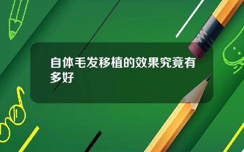 自体毛发移植的效果究竟有多好