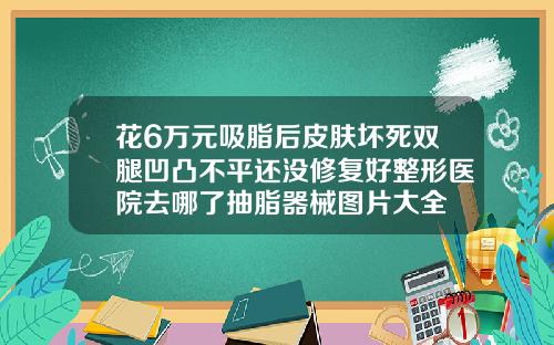 花6万元吸脂后皮肤坏死双腿凹凸不平还没修复好整形医院去哪了抽脂器械图片大全