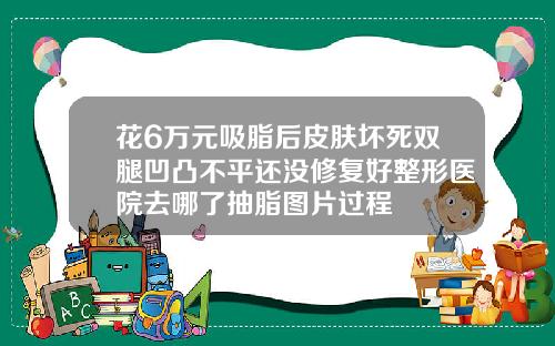 花6万元吸脂后皮肤坏死双腿凹凸不平还没修复好整形医院去哪了抽脂图片过程