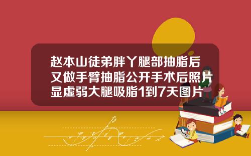 赵本山徒弟胖丫腿部抽脂后又做手臂抽脂公开手术后照片显虚弱大腿吸脂1到7天图片