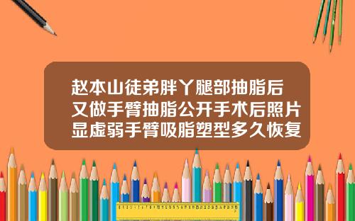 赵本山徒弟胖丫腿部抽脂后又做手臂抽脂公开手术后照片显虚弱手臂吸脂塑型多久恢复