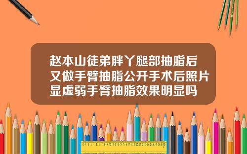 赵本山徒弟胖丫腿部抽脂后又做手臂抽脂公开手术后照片显虚弱手臂抽脂效果明显吗