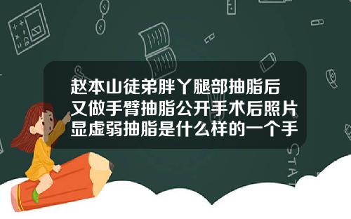 赵本山徒弟胖丫腿部抽脂后又做手臂抽脂公开手术后照片显虚弱抽脂是什么样的一个手术过程视频