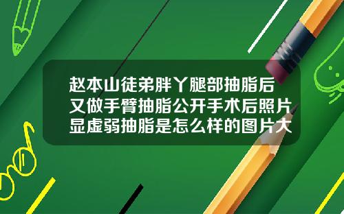 赵本山徒弟胖丫腿部抽脂后又做手臂抽脂公开手术后照片显虚弱抽脂是怎么样的图片大全