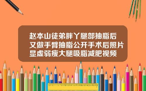 赵本山徒弟胖丫腿部抽脂后又做手臂抽脂公开手术后照片显虚弱瘦大腿吸脂减肥视频