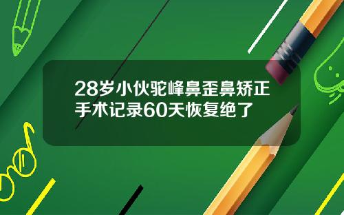 28岁小伙驼峰鼻歪鼻矫正手术记录60天恢复绝了