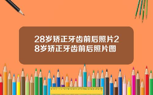 28岁矫正牙齿前后照片28岁矫正牙齿前后照片图
