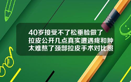 40岁接受不了松垂脸做了拉皮公开几点真实遭遇疼和肿太难熬了颈部拉皮手术对比照片