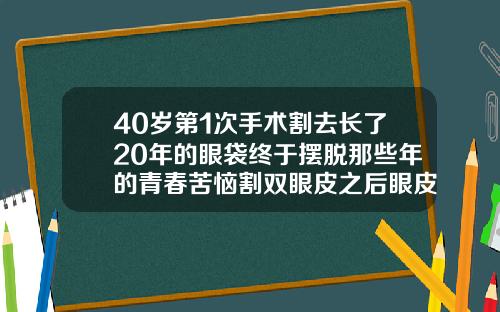40岁第1次手术割去长了20年的眼袋终于摆脱那些年的青春苦恼割双眼皮之后眼皮发黑