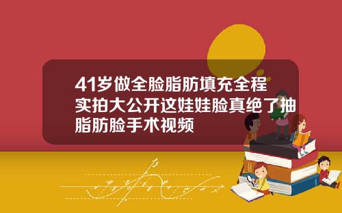 41岁做全脸脂肪填充全程实拍大公开这娃娃脸真绝了抽脂肪脸手术视频