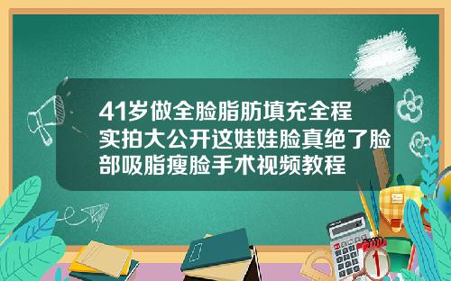 41岁做全脸脂肪填充全程实拍大公开这娃娃脸真绝了脸部吸脂瘦脸手术视频教程