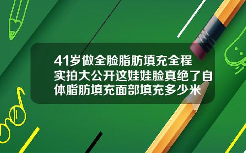 41岁做全脸脂肪填充全程实拍大公开这娃娃脸真绝了自体脂肪填充面部填充多少米