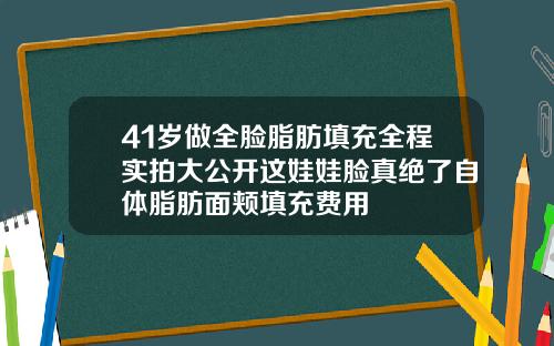 41岁做全脸脂肪填充全程实拍大公开这娃娃脸真绝了自体脂肪面颊填充费用