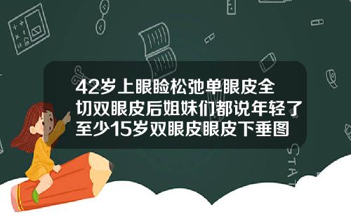 42岁上眼睑松弛单眼皮全切双眼皮后姐妹们都说年轻了至少15岁双眼皮眼皮下垂图片